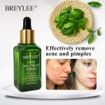 acne-treatment-serum-image-9.jpg